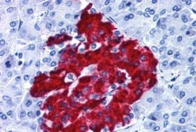 Immunohistochemistry-Paraffin: GPR82 Antibody [NBP3-14363]